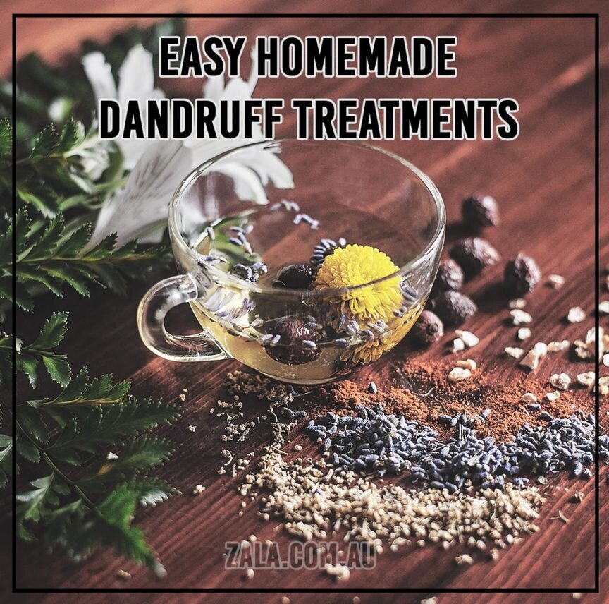 zala easy homemade dandruff treatments